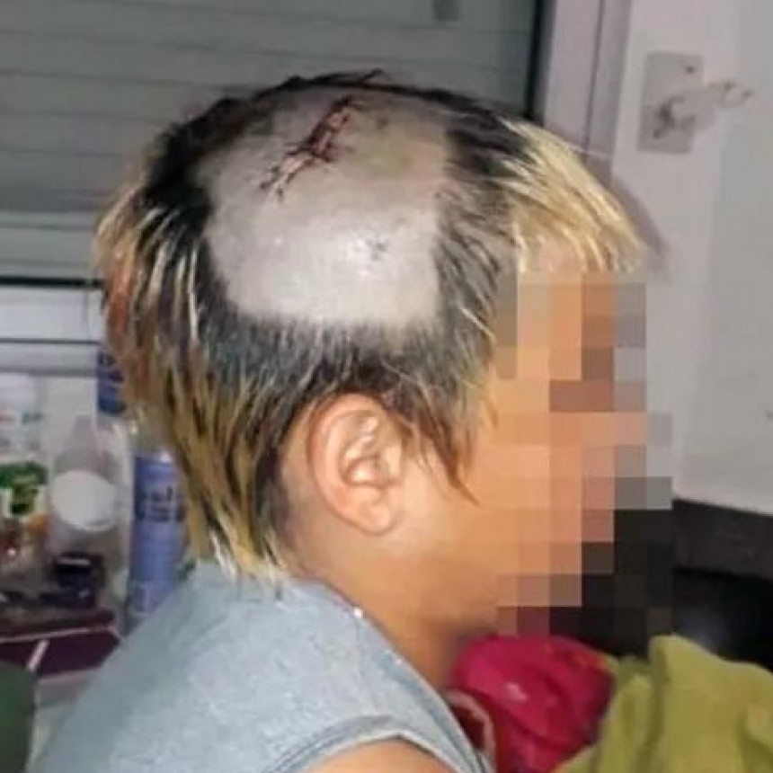 Un chico terminó con fractura de cráneo en un operativo y detuvieron a dos efectivos