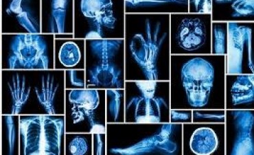 08 de noviembre Día Internacional de la Radiología